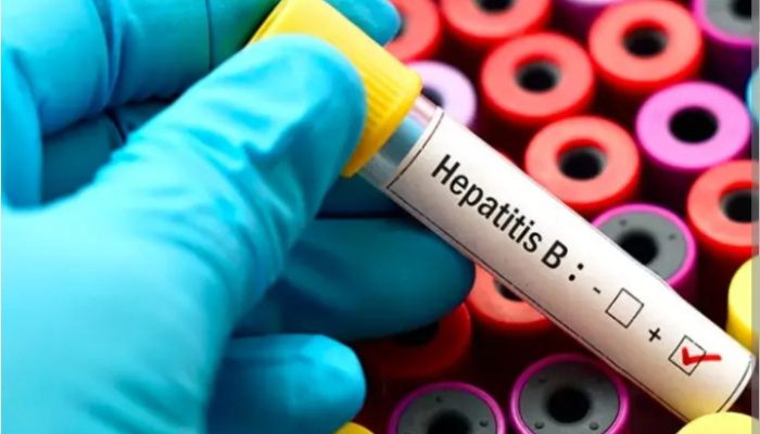 Dinkes Tulungagung Serius Lawan Penularan Hepatitis B Pada Bayi