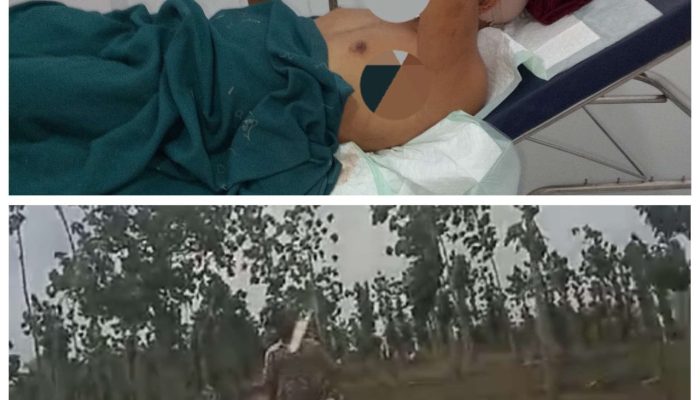 Polres Tuban Diminta Segera Tangkap Pelaku dan Dalang Pembacokan Wartawan